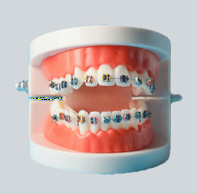 Orthodontic retainer appliance