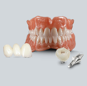 Fixed dental restorations