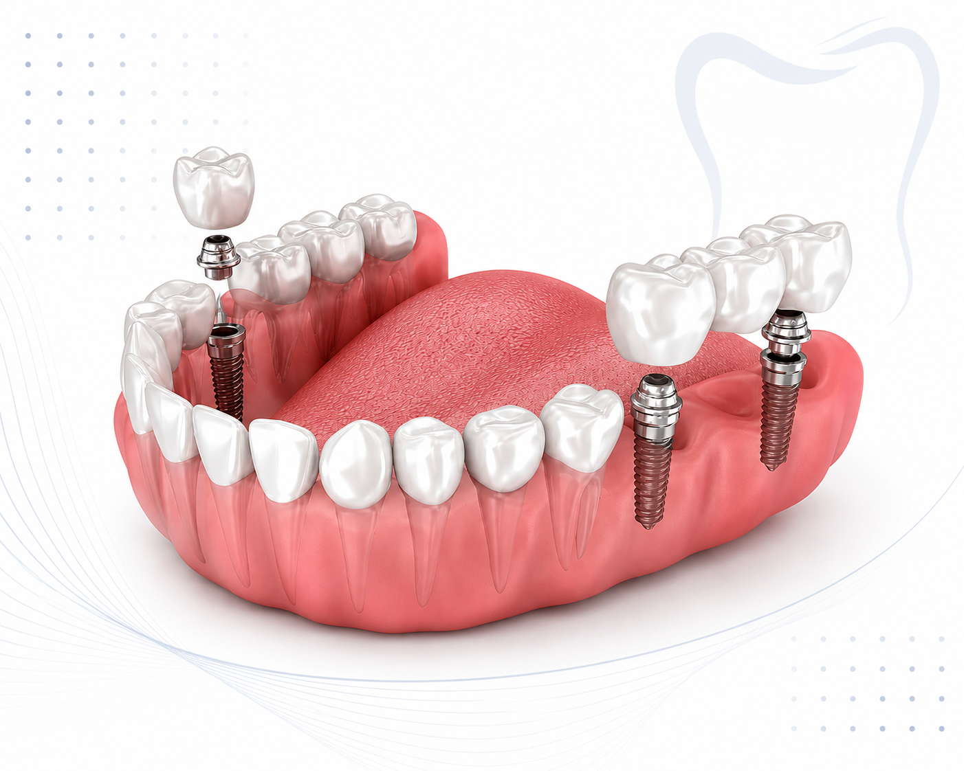 Premium zirconia dental crowns